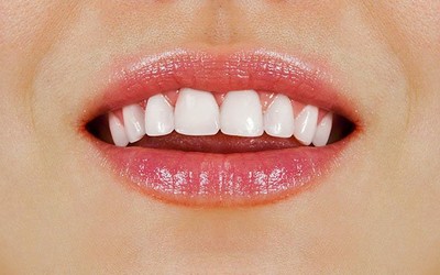 6 Tips To Keep For Healthy White Teeth In West Ryde