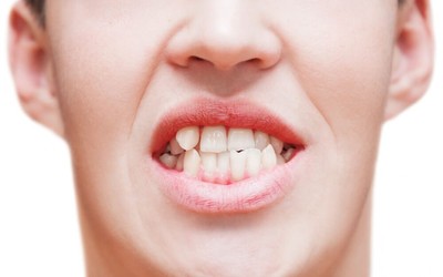 Crooked Teeth Treatment in West Ryde: 3 Orthodontic Solutions