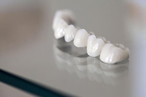 Dental Crowns and Bridges | Dentist West Ryde