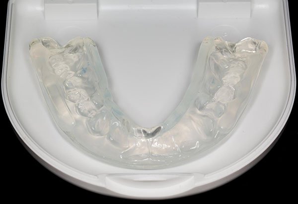 Dental Night Guards for Tooth Grinding at My Local Dentists West Ryde