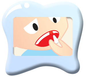 Knocked-out Tooth | Dentist West Ryde