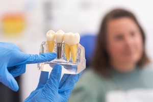 Check NSSydneyDentalImplants.com.au