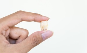 broken tooth