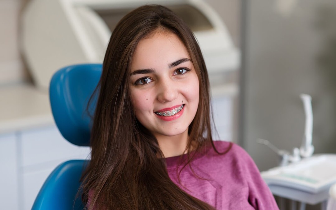 The Importance of Correcting your Overbite from My Local Dentists West Ryde